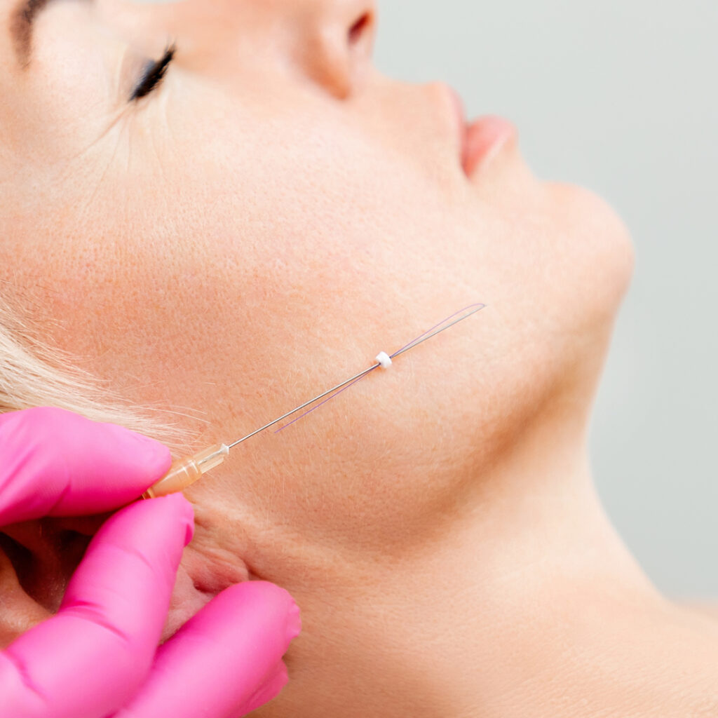 ショッピングリフトをしているところ