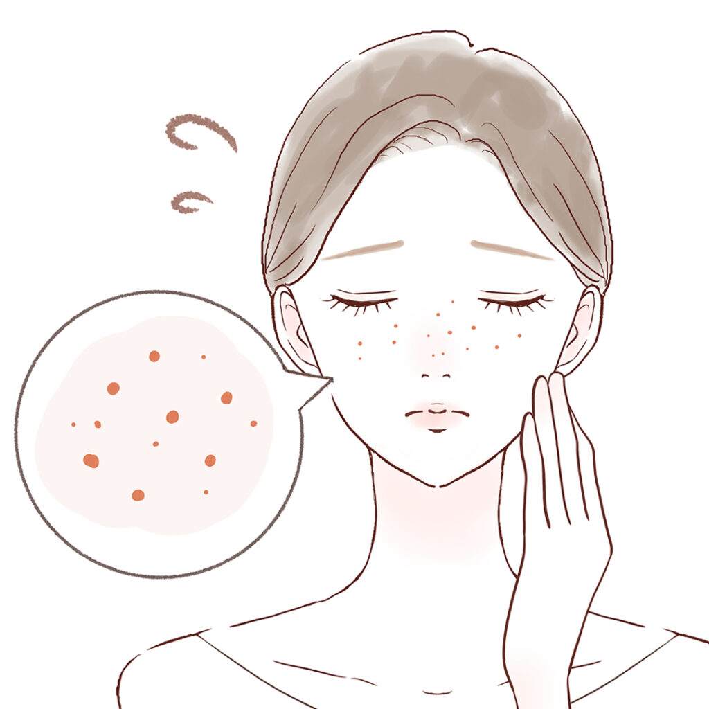 福岡で毛穴でなやんでいる女性のイメージのイラスト