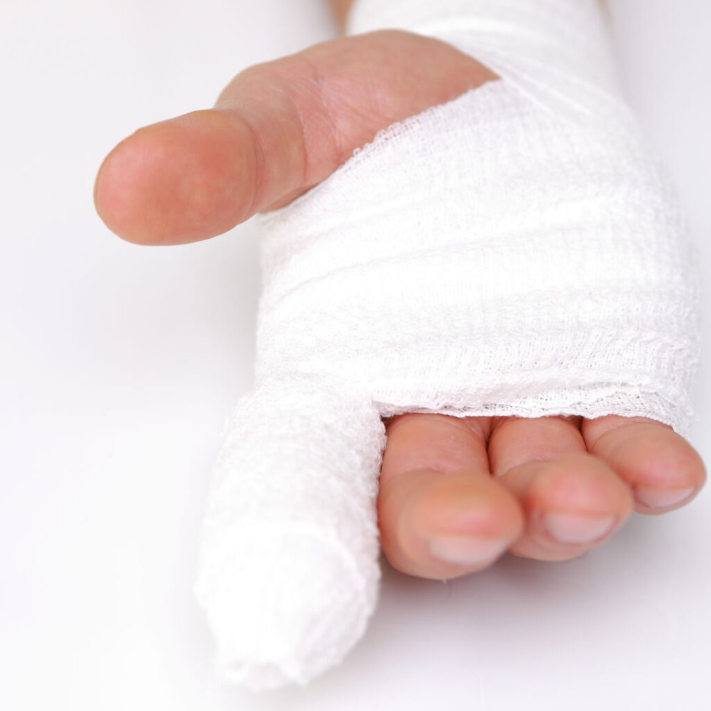 ケガを縫合した手