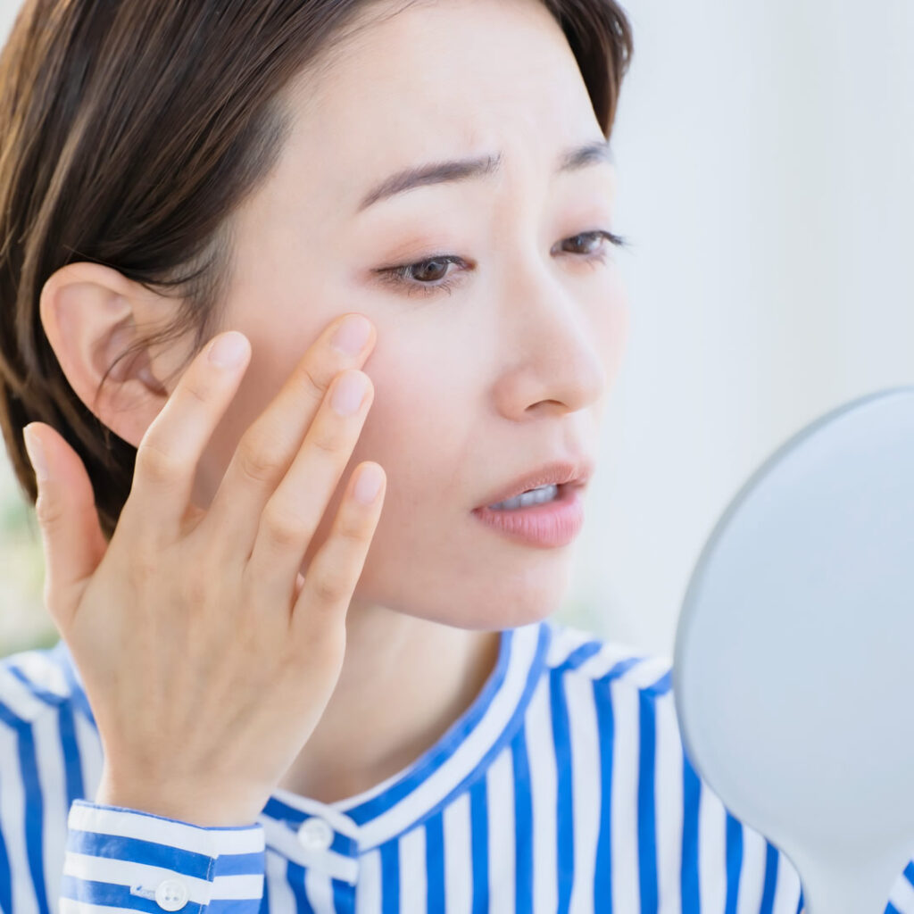 シミやそばかすが気になっている女性