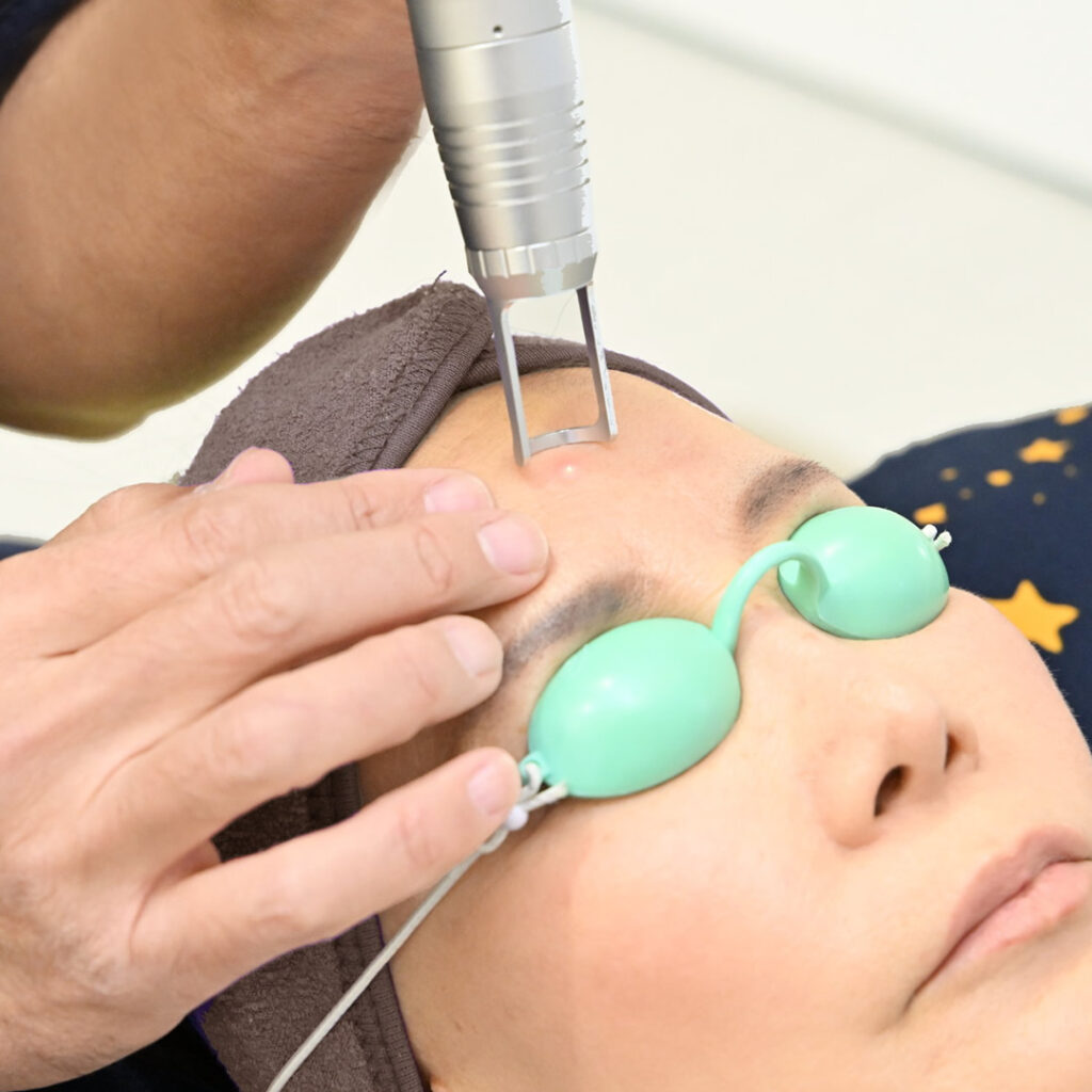 レーザー治療をしている様子