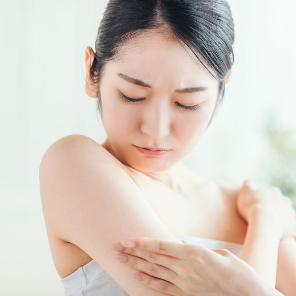 毛孔性苔癬を気にしている女性