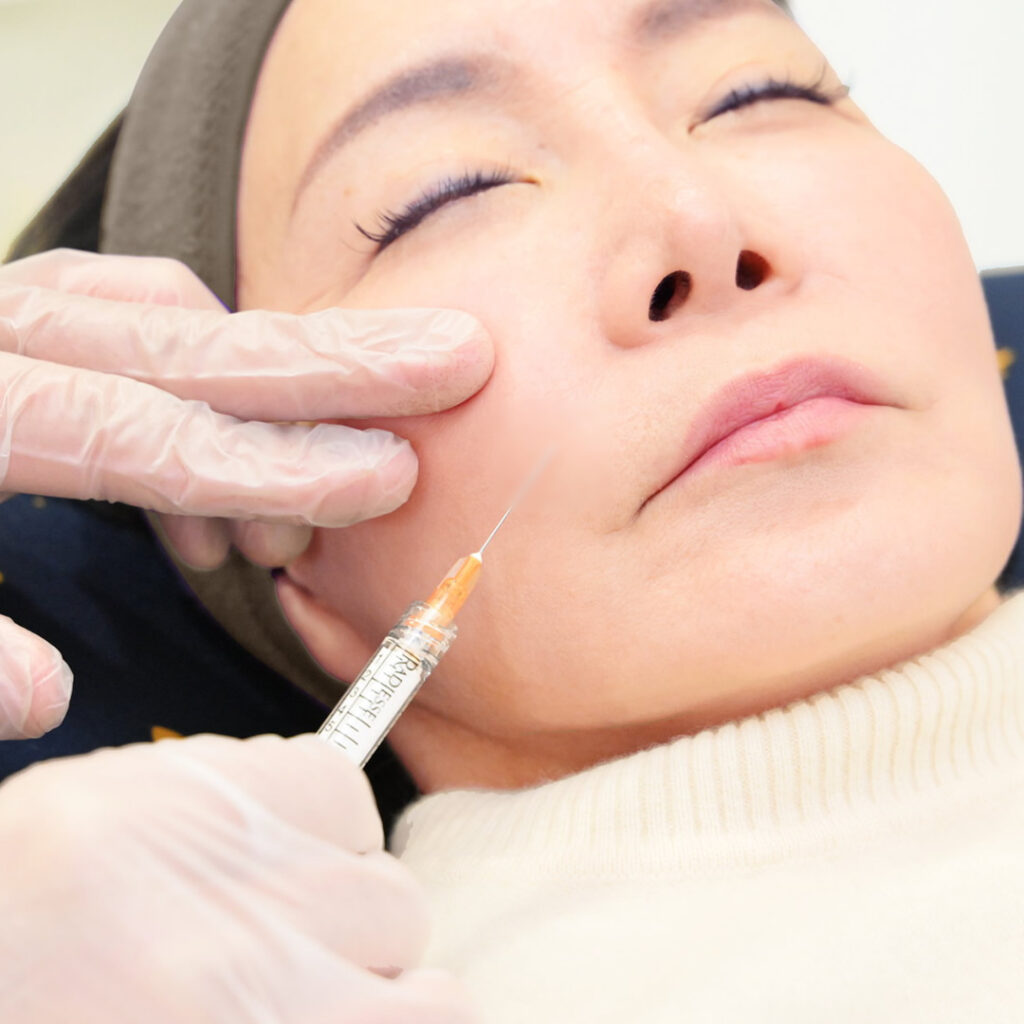 ヒアルロン酸注入しているイメージ