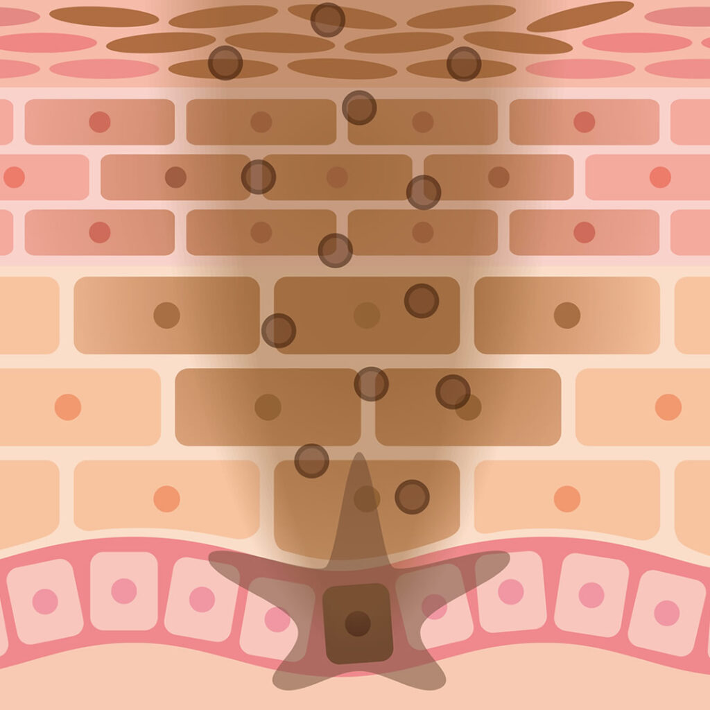 色素沈着の図解