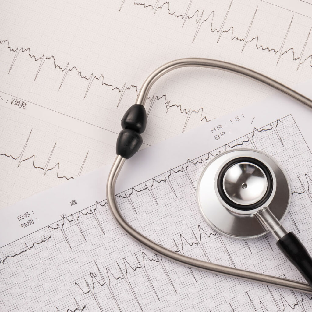 心エコーのイメージ